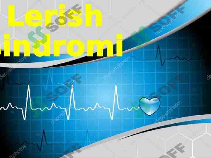 Lerish sindromi