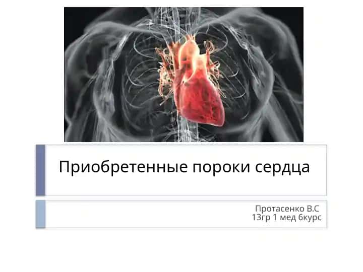 Приобретенные пороки сердца