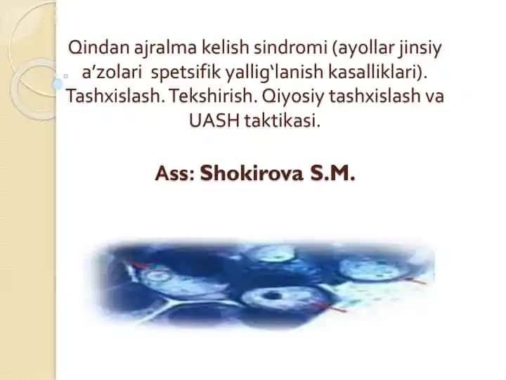 Qindan ajralma kelish sindromi (ayollar jinsiy a’zolari spetsifik yallig‘lanish kasalliklari) tashxislash, tekshirish, qiyosiy tashxislash va UASH taktikasi