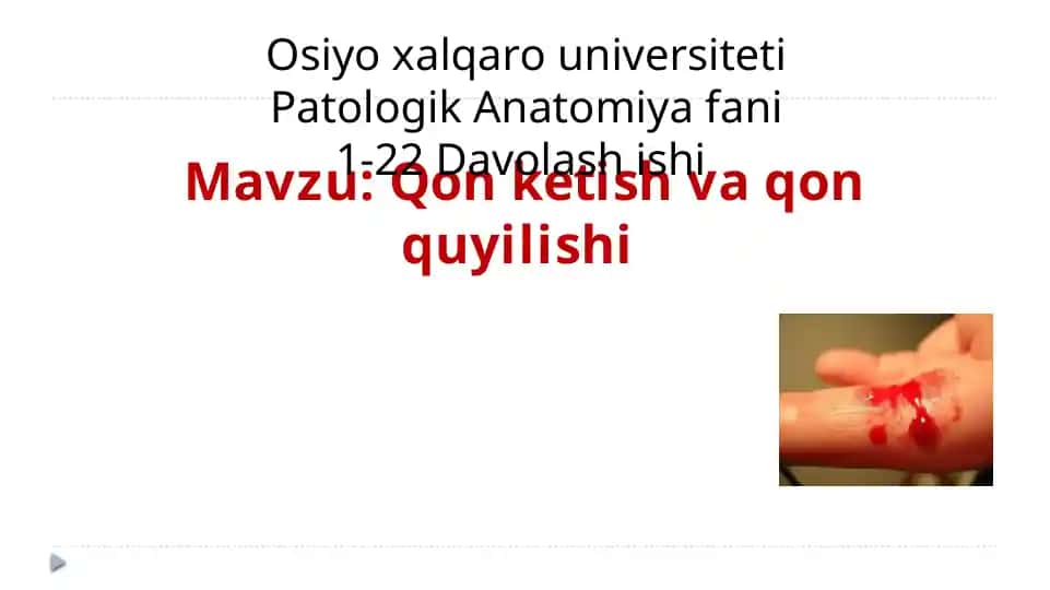 Qonketish va qon quyilishi