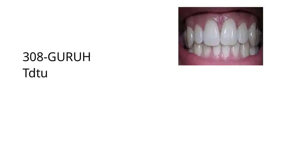 Tishnuqsonlarining xalqaro tasnifi