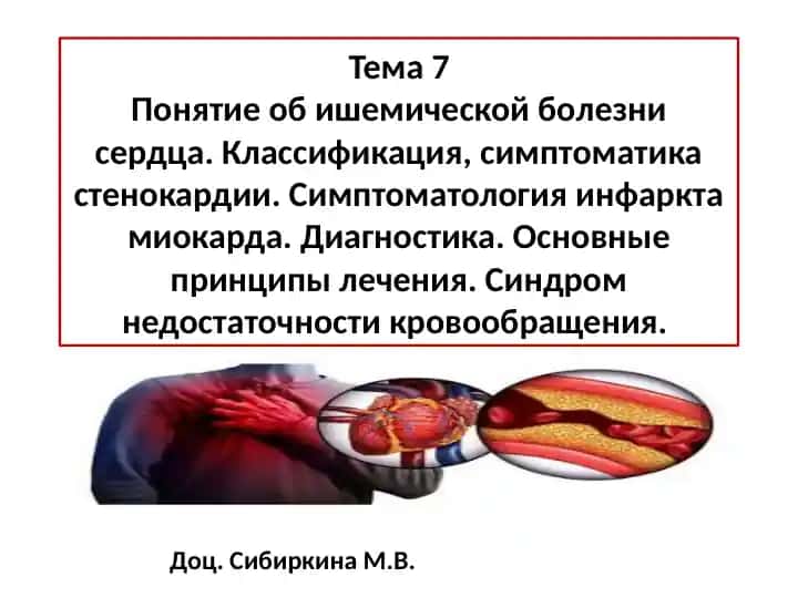 Ишемическая болезнь сердца