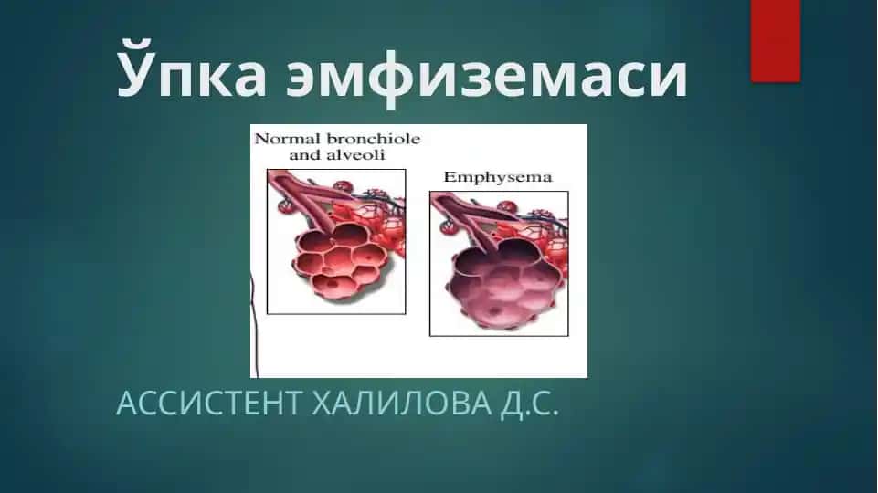 Ўпка эмфиземаси