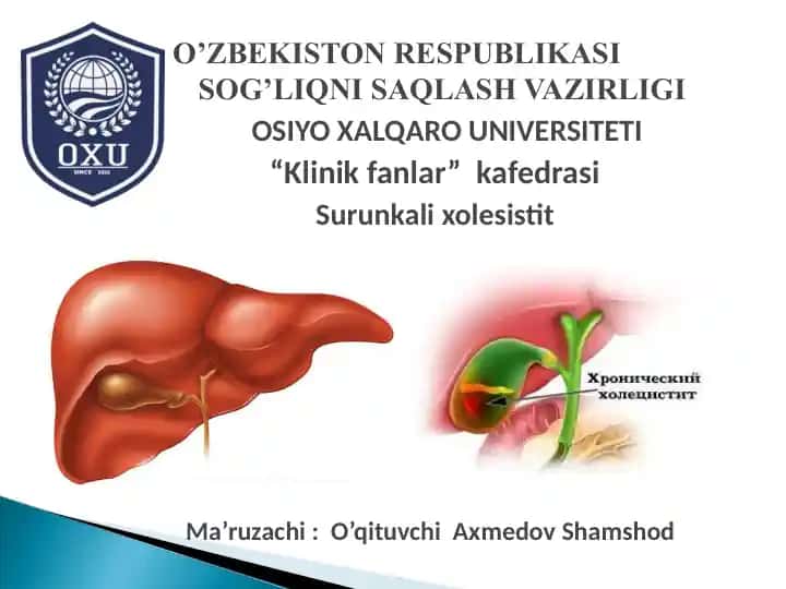 Surunkali xolesistit