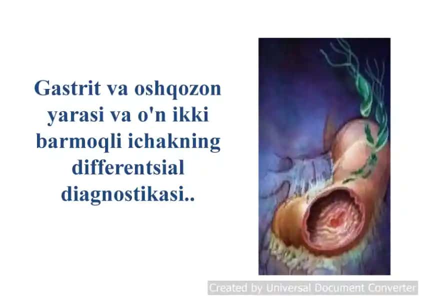 Oshqozon kasalliklari