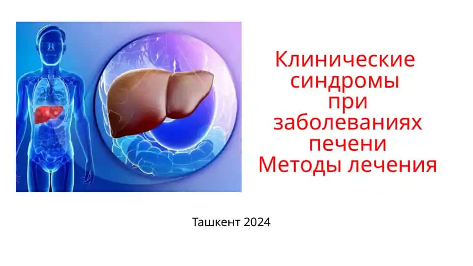 Клинические синдромы при заболеваниях печени. Методы лечения
