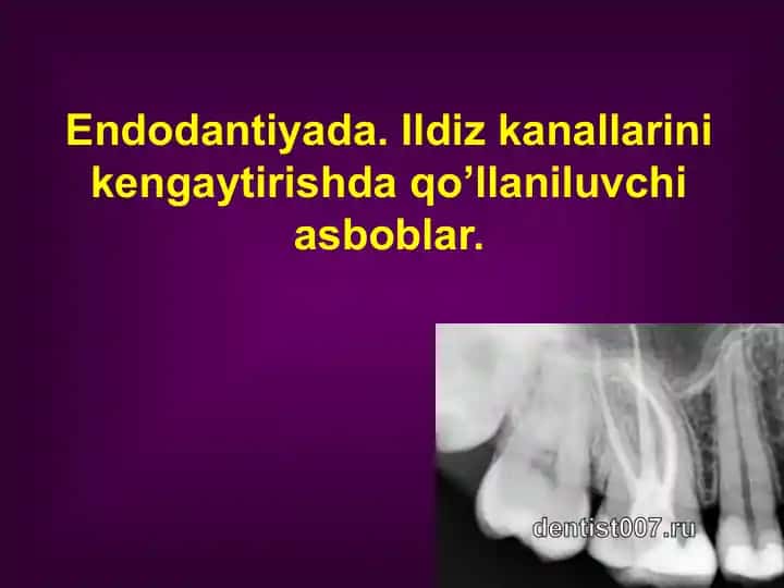 Endodontik asboblar parametrlari