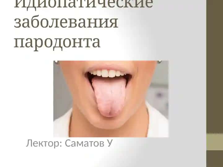 Идиопатические заболевания пародонта