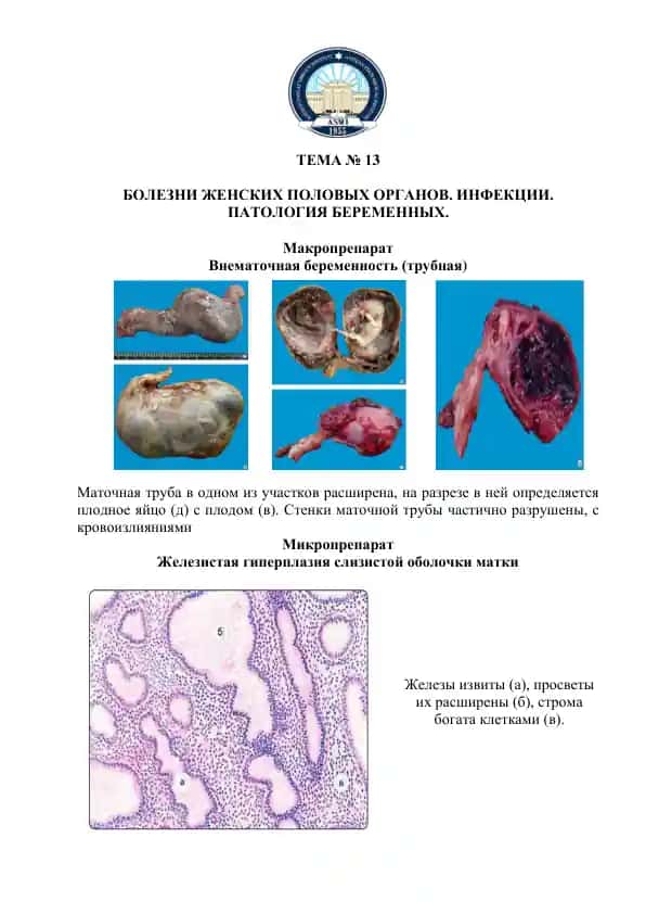 Bolezni jenskikh polovykh organov. Infektsii. Patologiya beremennykh.