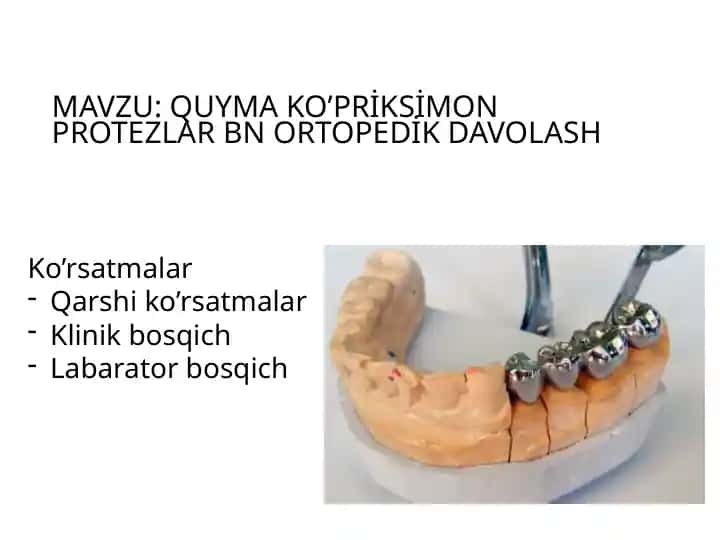 Quyma ko’priksimon protezlar