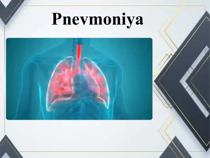 Pnevmoniya