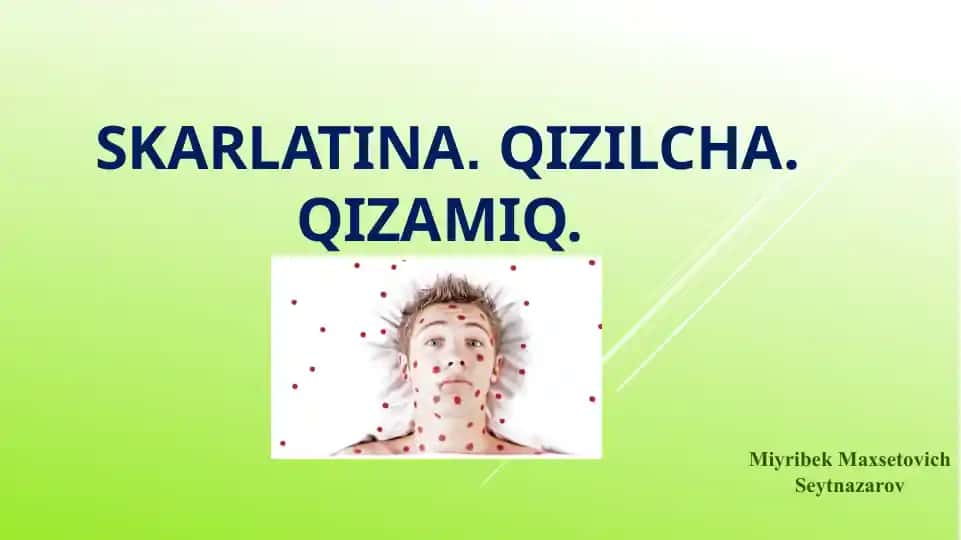 Skarlatina, Qizilcha, Qizamiq