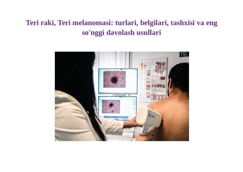 Teri raki, Teri melanomasi turlari, belgilari, tashxisi va eng so'nggi davolash usullari