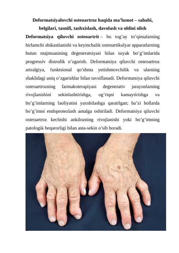 Deformatsiyalovchi osteoartroz
