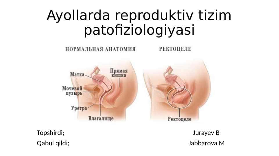 Ayollarda reproduktiv tizim patofiziologiyasi