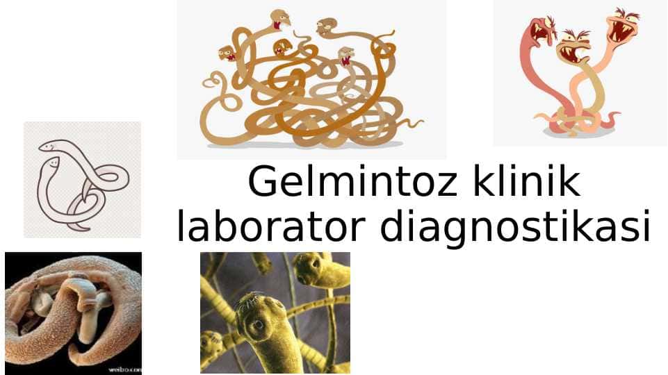 Gelmintoz klinik laborator diagnostikasi