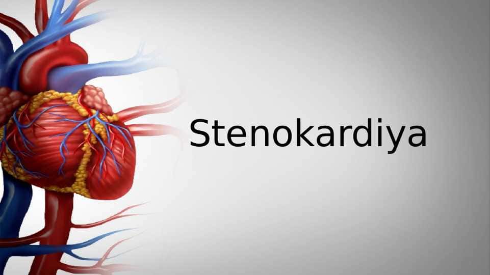 Stenokardiya