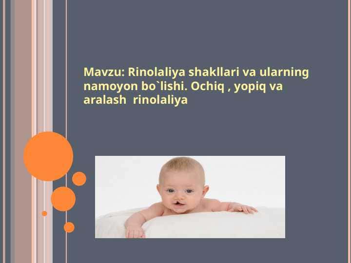 Rinolaliya shakllari va ularning namoyon bo`lishi. Ochiq , yopiq va aralash rinolaliya