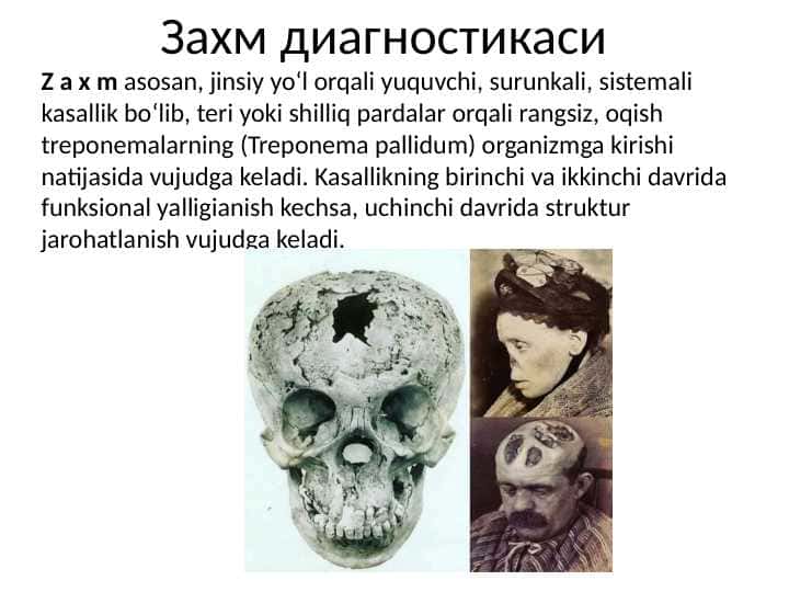 ZAXM KASALLIGI. ZAXM DIAGNOSTIKASI