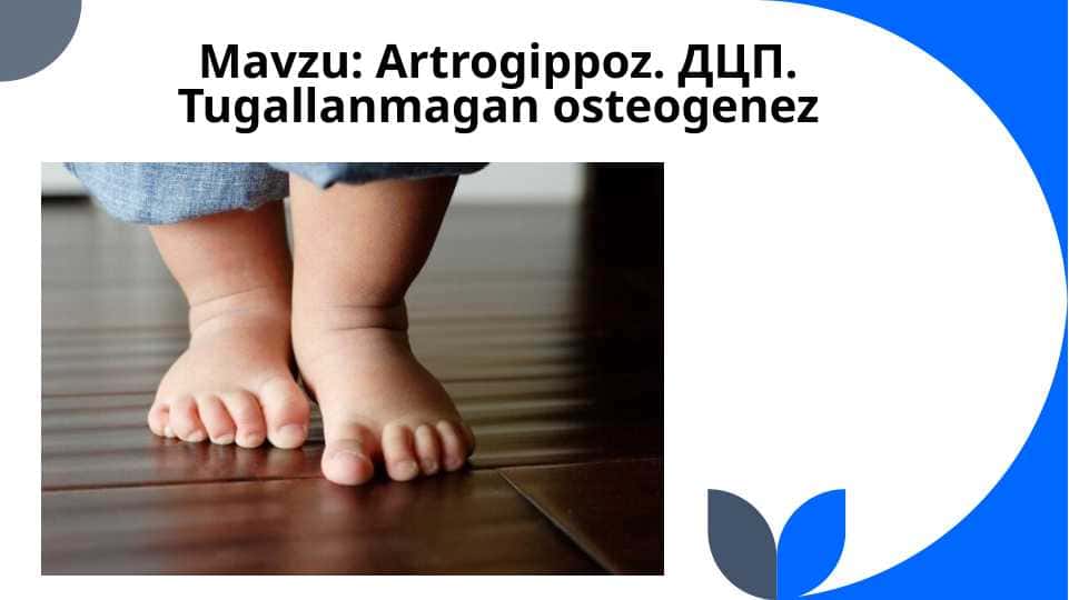 Artrogippoz. ДЦП. Tugallanmagan osteogenez