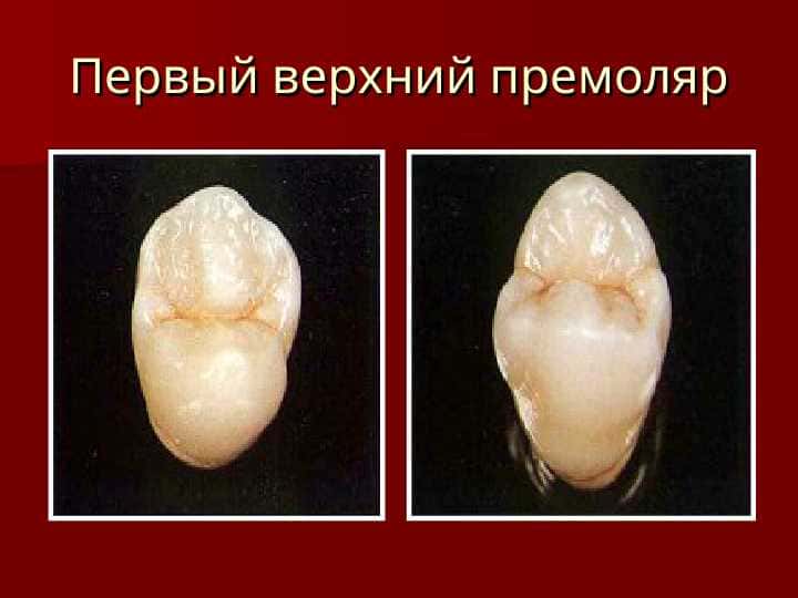 Первый верхний премоляр Второй верхний премоляр При восстановлении премоляров нижней челюсти необходимо помнить: