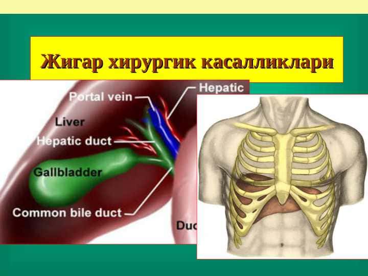 JIGARNING XIRURGIK KASALLIKLARI.