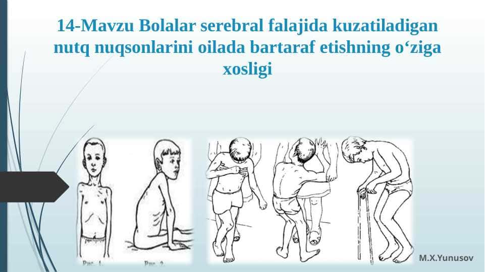 Bolalar serebral falajida kuzatiladigan nutq nuqsonlarini oilada bartaraf etishning o‘ziga xosligi