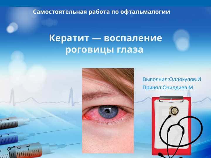 Кератит - воспаление роговицы глаза
