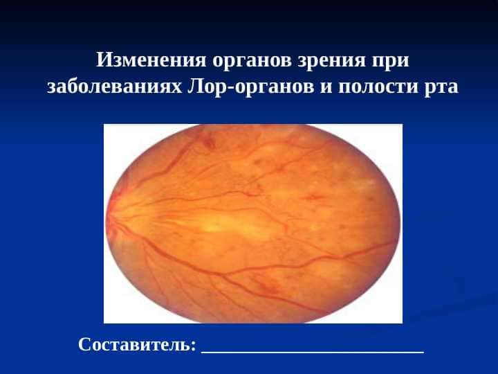Изменения органов зрения при заболеваниях Лор-органов и полости рта