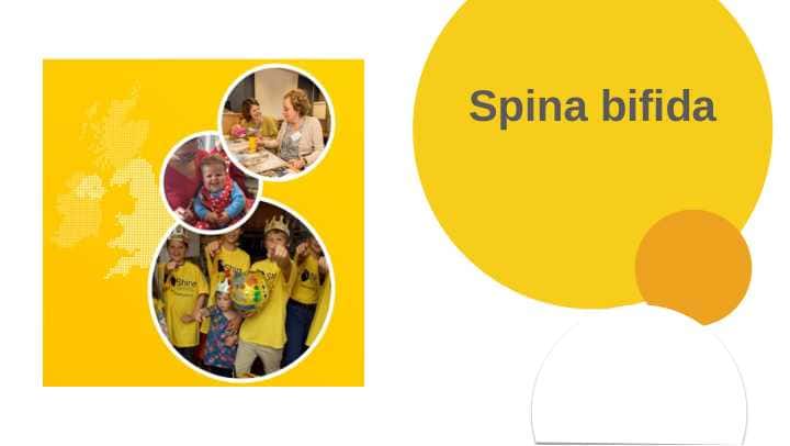 Spina bifida