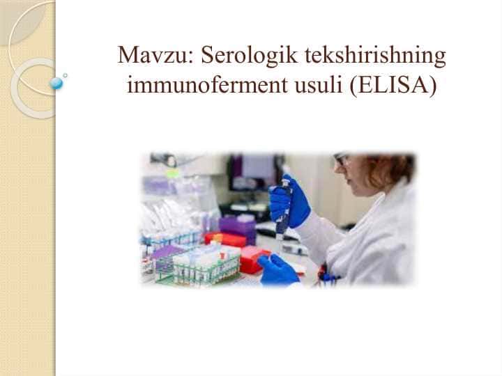 Serologik tekshirishning immunoferment usuli (ELISA)