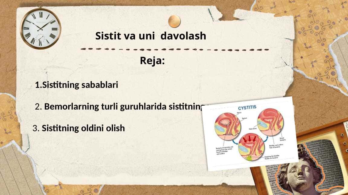 Sistit va uni davolash