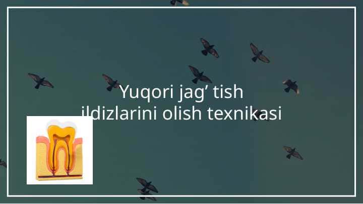 Yuqori jag' tishlari ildizlarni olish texnikasi