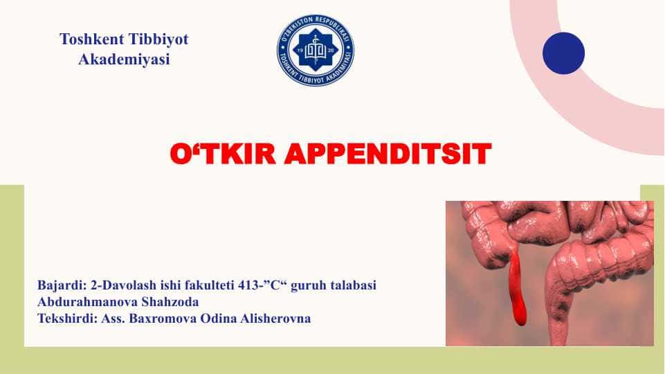 Appenditsit