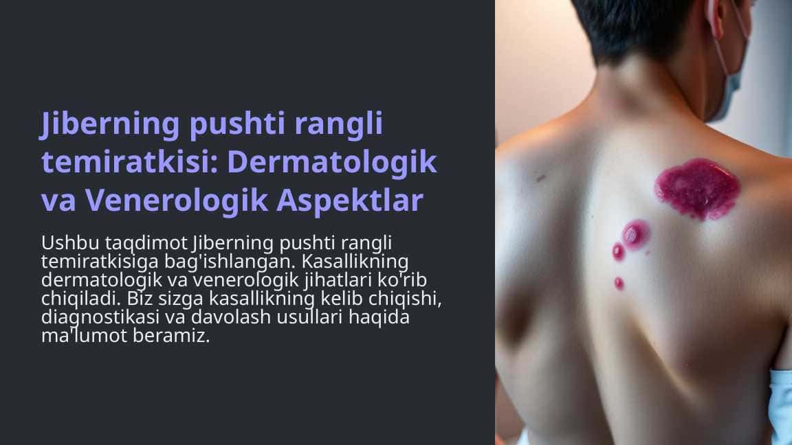 Jiberning pushti rangli temiratkisi