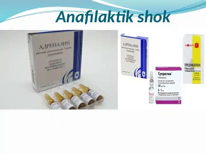 Anafilaktik shok
