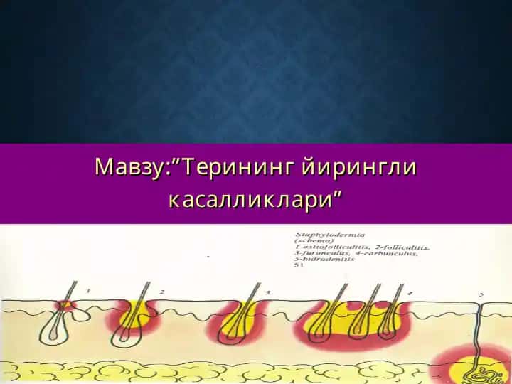 Терининг йирингли касалликлари