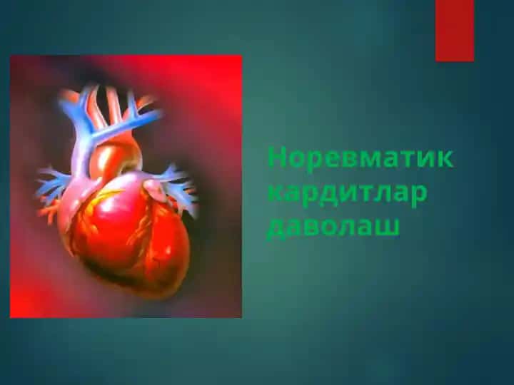Норевматик кардитлар даволаш