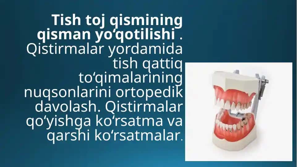 Tish toj qismining qisman yo’qotilishi