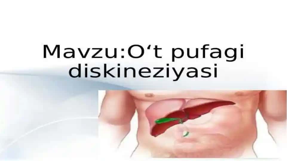O‘t yo‘llari diskineziyasi