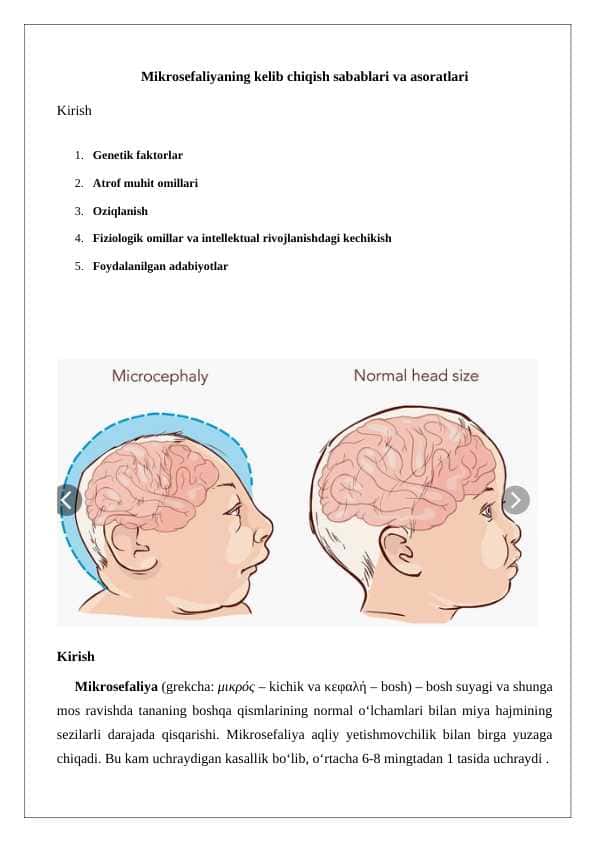 Mikrosefaliyaning kelib chiqish sabablari .