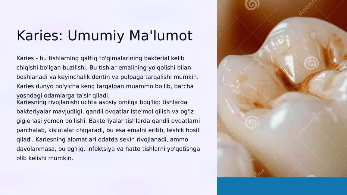 Karies. Tasnifi. Etiologiya. Patogenez. Kariesning klinik namoyon bo‘lishi.