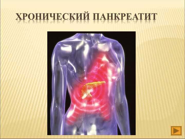 Хронический панкреатит