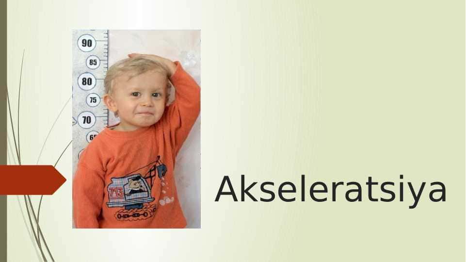 Akseleratsiya