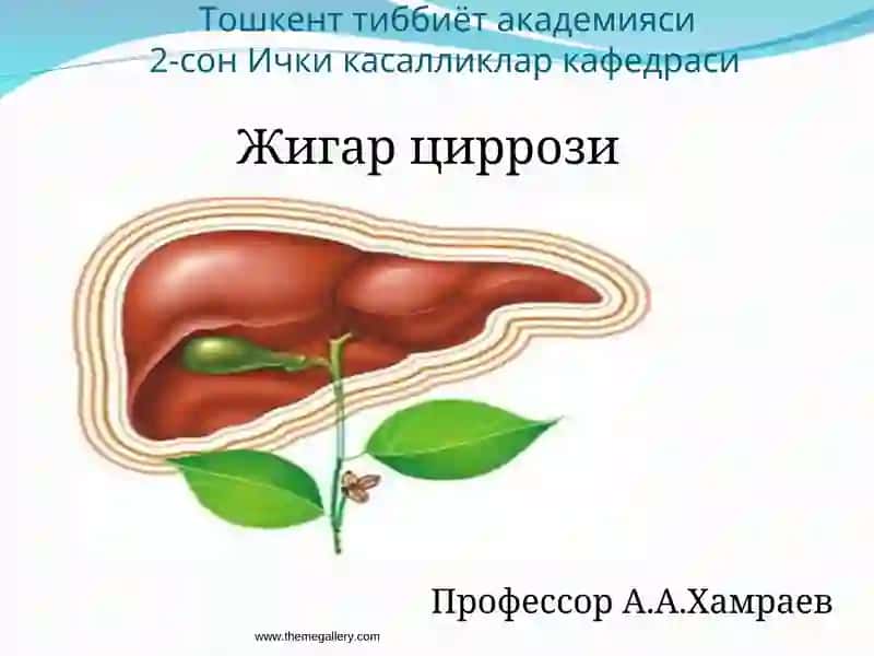 Жигар циррози
