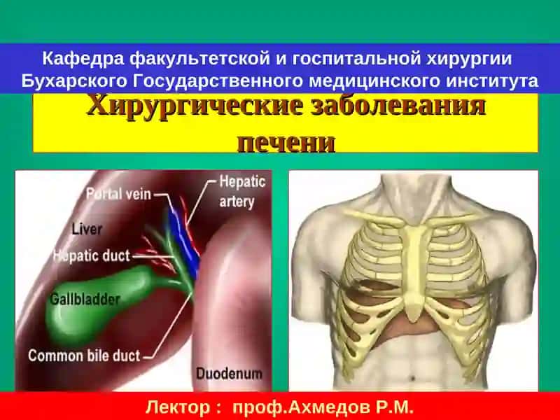 Хирургические заболевания печени