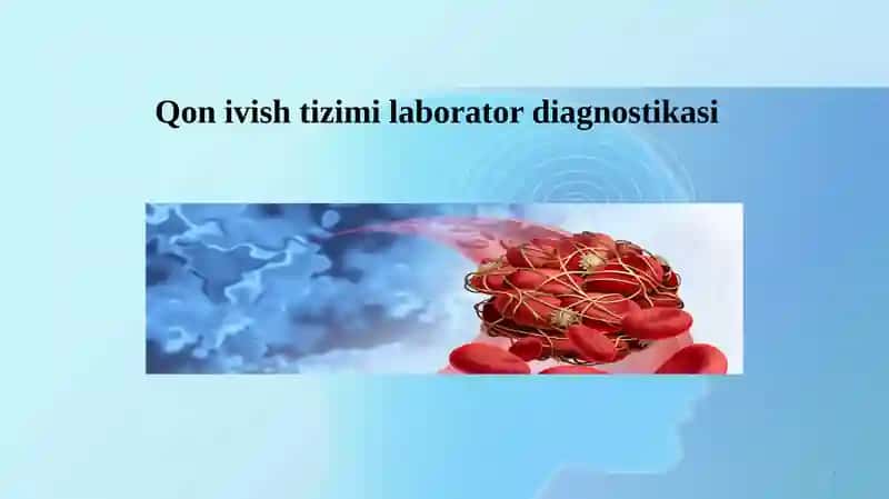 Qon ivish tizimi laborator diagnostikasi