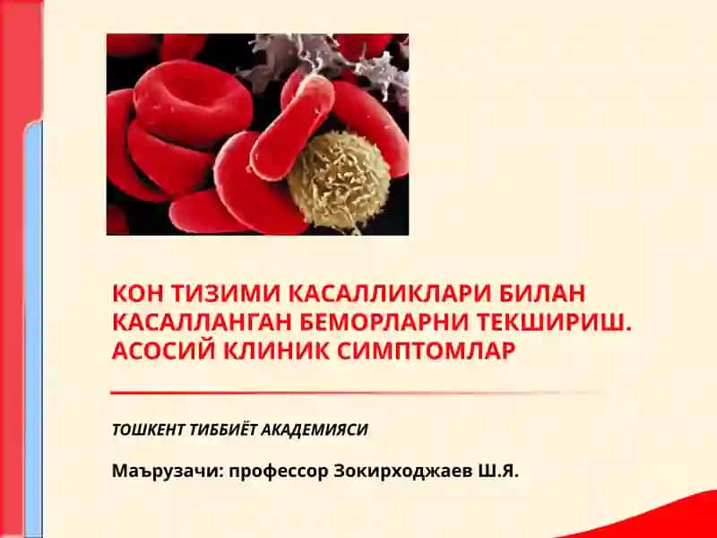 КОН ТИЗИМИ КАСАЛЛИКЛАРИ БИЛАН КАСАЛЛАНГАН БЕМОРЛАРНИ ТЕКШИРИШ. АСОСИЙ КЛИНИК СИМПТОМЛАР
