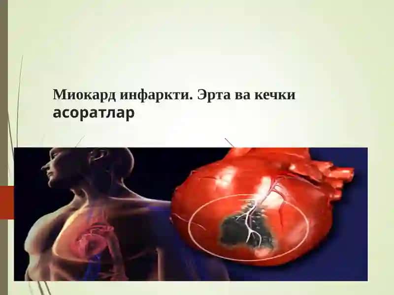 Миокард инфаркти