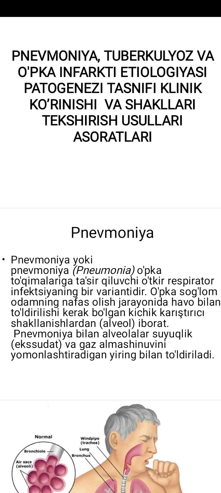 PNEVMONIYA, TUBERKULYOZ VA O'PKA INFARKTI ETIOLOGIYASI PATOGENEZI